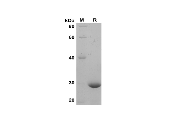 Recombinant Mouse CXCL1 Protein(Trx Tag)-1