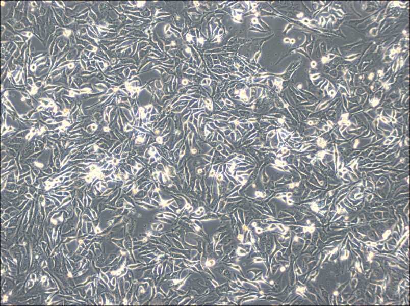 NCI-H596 Cell Complete Medium - 2