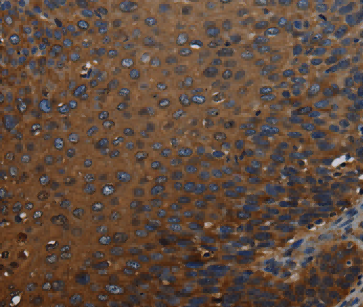 IVL Polyclonal Antibody - 2