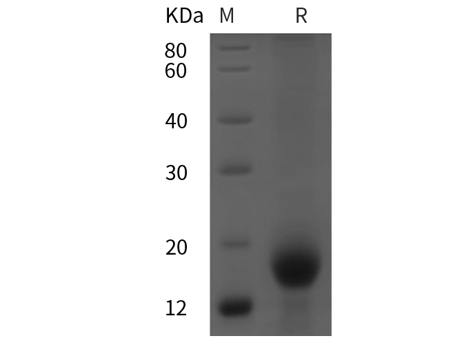 Recombinant Human IL-33 Protein(TRX Tag)-产品推荐-1