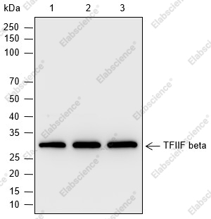 Recombinant TFIIF beta Monoclonal Antibody - 1