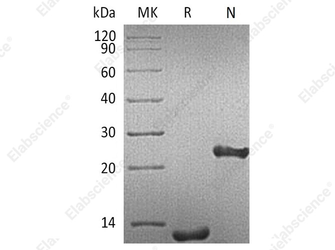 Recombinant Human TGFB1/TGF-beta 1 Protein - 1