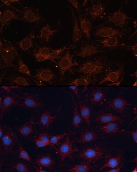 Immunofluorescence analysis of C6 cells using SLC25A24 Polyclonal Antibody at dilution of  1:100. Blue: DAPI for nuclear staining.