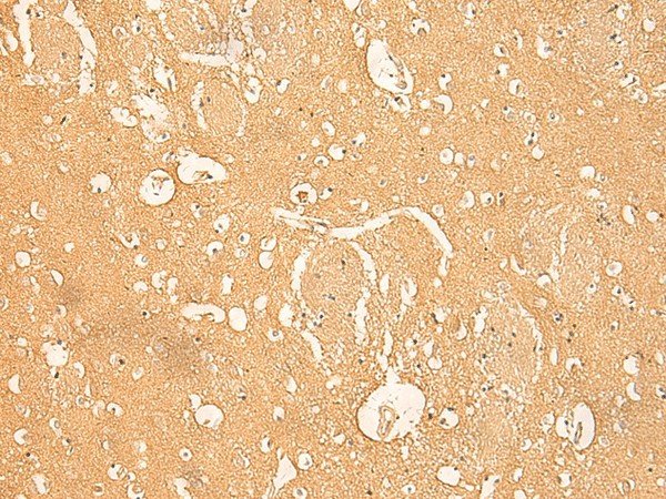 Immunohistochemistry of paraffin-embedded Human brain tissue  using RNASE4 Polyclonal Antibody at dilution of 1:45(?200)