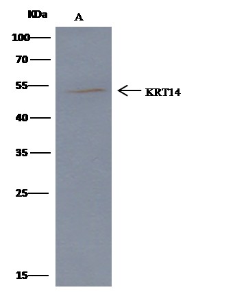 Recombinant KRT14/Cytokeratin 14 Monoclonal Antibody - small - 3