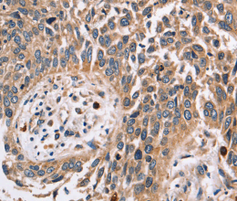 FUCA1 Polyclonal Antibody - 3