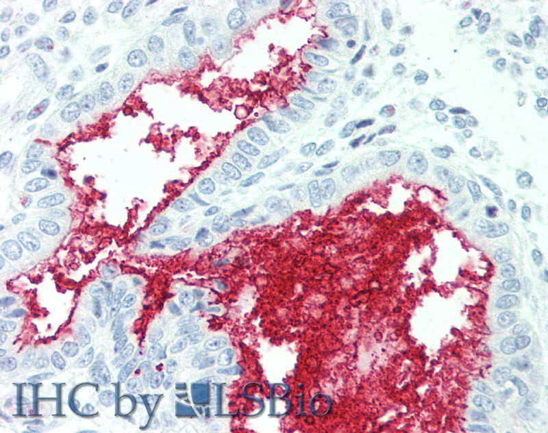 Immunohistochemistry of paraffin-embedded Human Uterus tissue using SLC34A2 Polyclonal Antibody at dilution of 1:60(Elabscience Product Detected by Lifespan).