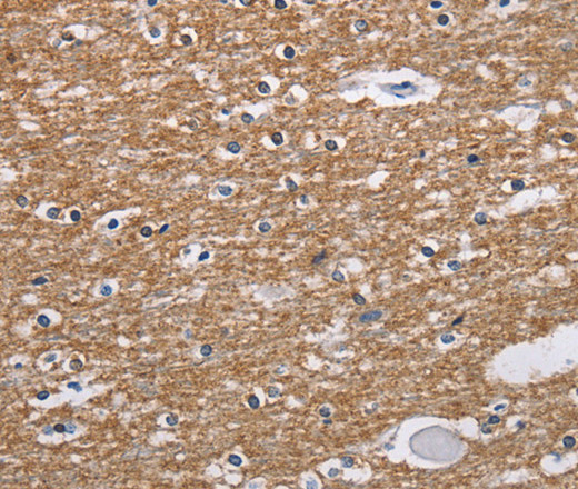 Immunohistochemistry of paraffin-embedded Human brain  tissue using NCR2 Polyclonal Antibody at dilution 1:60