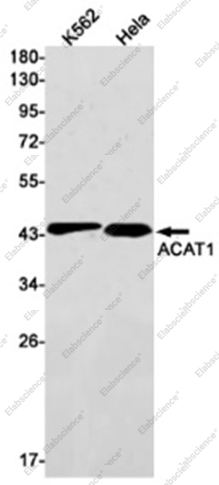 Recombinant ACAT1 Monoclonal Antibody - 1