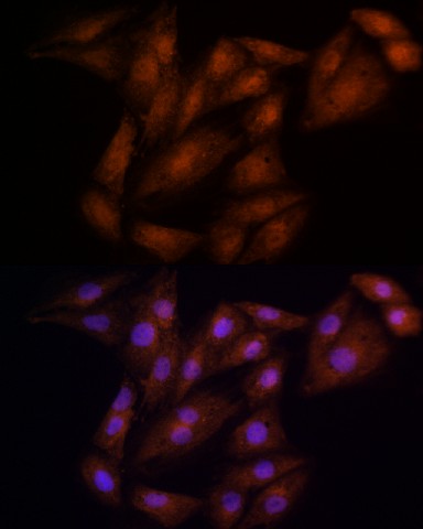 Immunofluorescence analysis of H9C2 cells using ECSIT Polyclonal Antibody at dilution of 100 (40x lens). Blue: DAPI for nuclear staining.