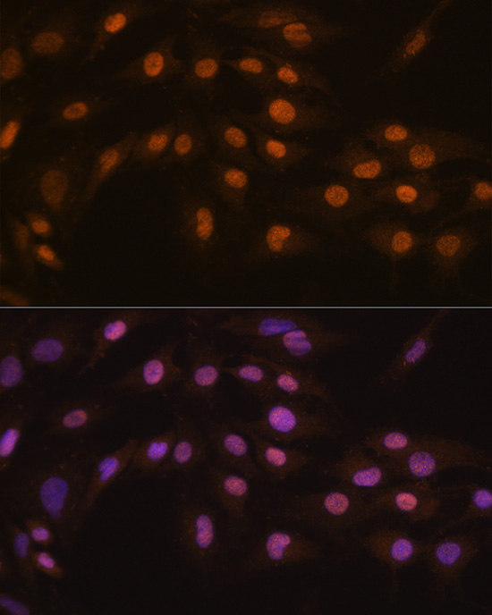 Immunofluorescence analysis of C6 cells using ZFPM1 Polyclonal Antibody at dilution of 1:100 (40x lens). Blue: DAPI for nuclear staining.