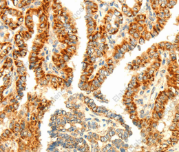 AARS2 Polyclonal Antibody - 2