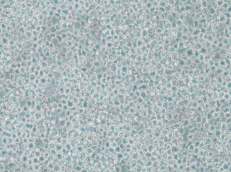 SKNO-1 Cell Complete Medium - 5