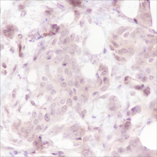 Recombinant Caspase-7 Monoclonal Antibody - 2