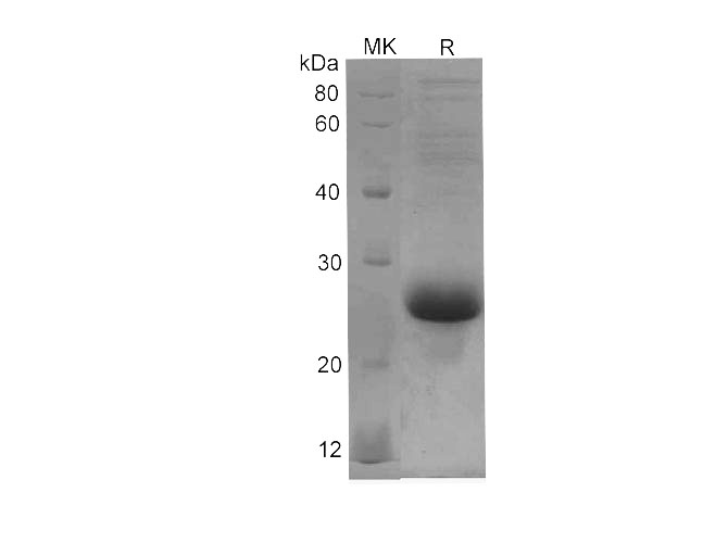Recombinant Human IL-33 Protein(TRX Tag)-产品推荐-1