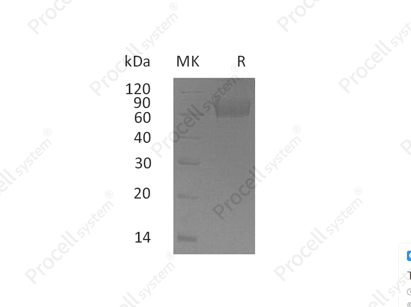 IL-18BP (C-Fc), Human, Recombinant