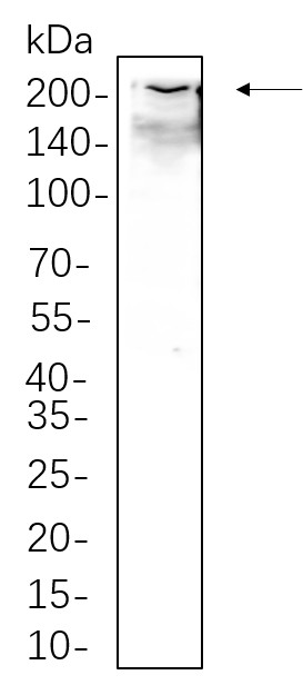Recombinant Collagen I Monoclonal Antibody-searchlist-1