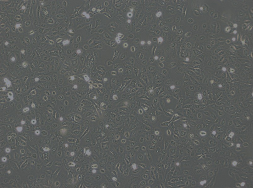 OVCA429 Cell Complete Medium - 3