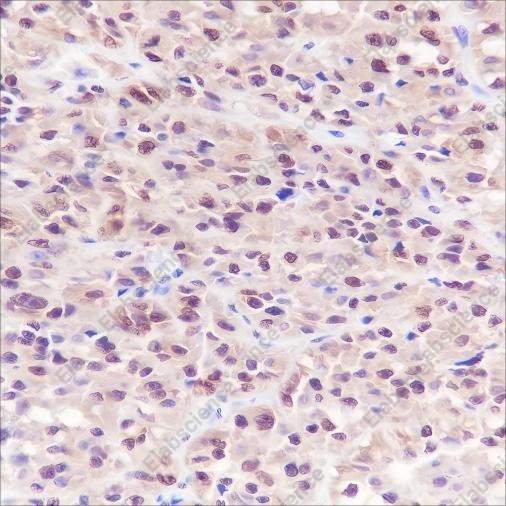 Recombinant S100A1 Monoclonal Antibody - 3