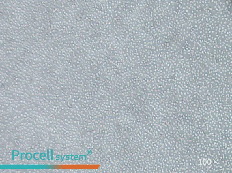 skm-1 Cell Complete Medium - 1