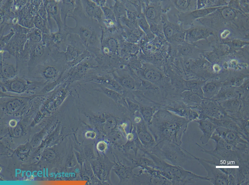 Human Synovial Fibroblast (Primary cell immortalization) Complete MediumHuman Synovial Fibroblast (Primary cell immortalization) Complete Medium - 5