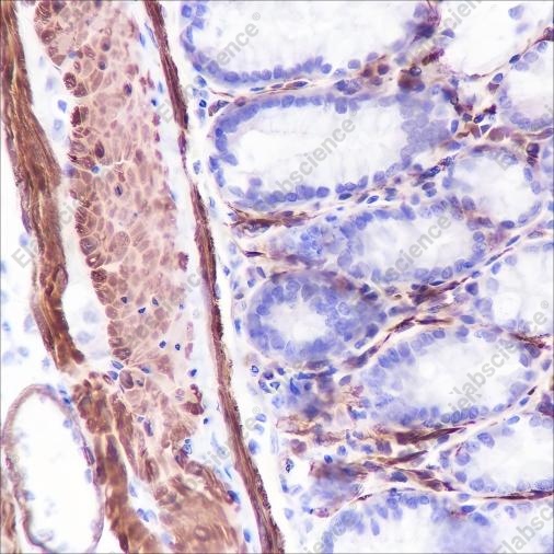 Recombinant Caldesmon/CDM Monoclonal Antibody - 3