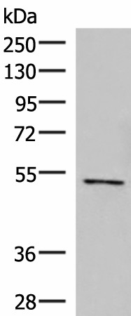 Western blot analysis of Jurkat cell lysate  using POLD2 Polyclonal Antibody at dilution of 1:800