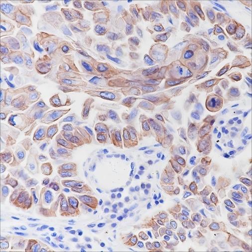 Recombinant Keratin 6 Monoclonal Antibody - small - 4