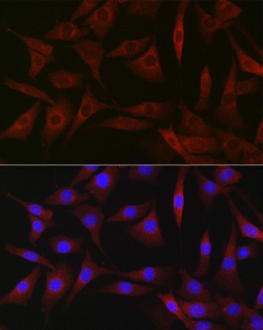 Immunofluorescence analysis of NIH-3T3 cells using BDKRB1 Polyclonal Antibody at dilution of 1:200 (40x lens). Blue: DAPI for nuclear staining.