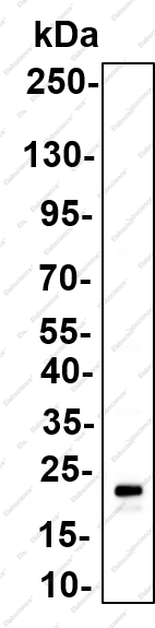 Recombinant GCDFP-15 Monoclonal Antibody - 2