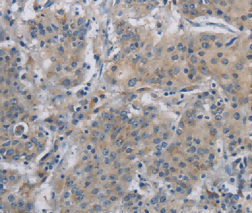 DNAJB4 Polyclonal Antibody - 2