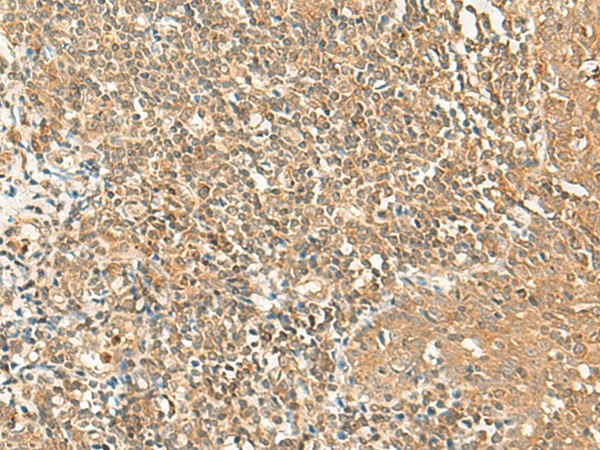 Immunohistochemistry of paraffin-embedded Human tonsil tissue  using GRIPAP1 Polyclonal Antibody at dilution of 1:50(?200)