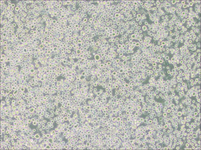 MEG-01 Cell Complete MediumMEG-01 Cell Complete Medium - 3