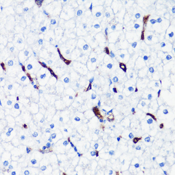 Immunohistochemistry of paraffin-embedded Human liver using HO-1 Polyclonal Antibody at dilution of  1:200 (40x lens).