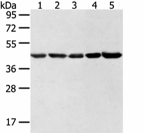 Western blot analysis of Hela lncap NIH/3T3 K562 and 231 cell  using WDR77 Polyclonal Antibody at dilution of 1:500