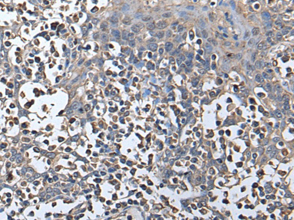 Immunohistochemistry of paraffin-embedded Human tonsil tissue  using ZNHIT1 Polyclonal Antibody at dilution of 1:40(?200)