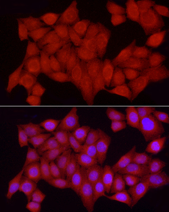 Immunofluorescence analysis of HeLa cells using [KO Validated] PTPN2 Polyclonal antibody at dilution of 1:250 (40x lens). Blue: DAPI for nuclear staining.