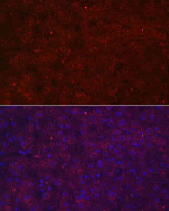 Immunofluorescence analysis of human liver cells using LRG1 Polyclonal antibody at dilution of 1:100 (40x lens). Blue: DAPI for nuclear staining.