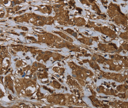 ARHGDIA Polyclonal Antibody - 3