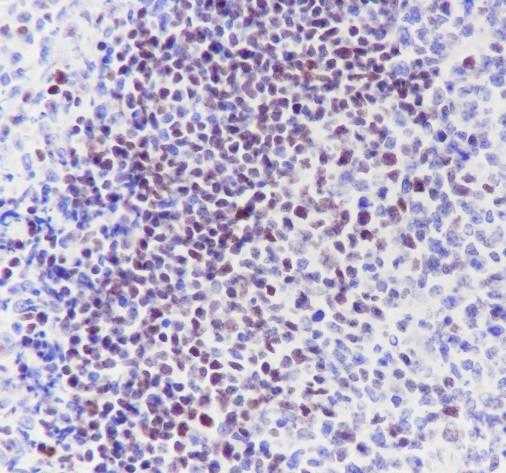 Recombinant SATB1 Monoclonal Antibody - 2