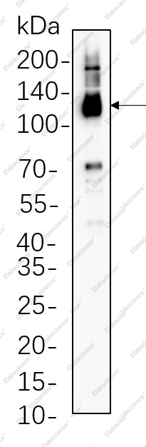 Recombinant Notch2 Monoclonal Antibody - 1