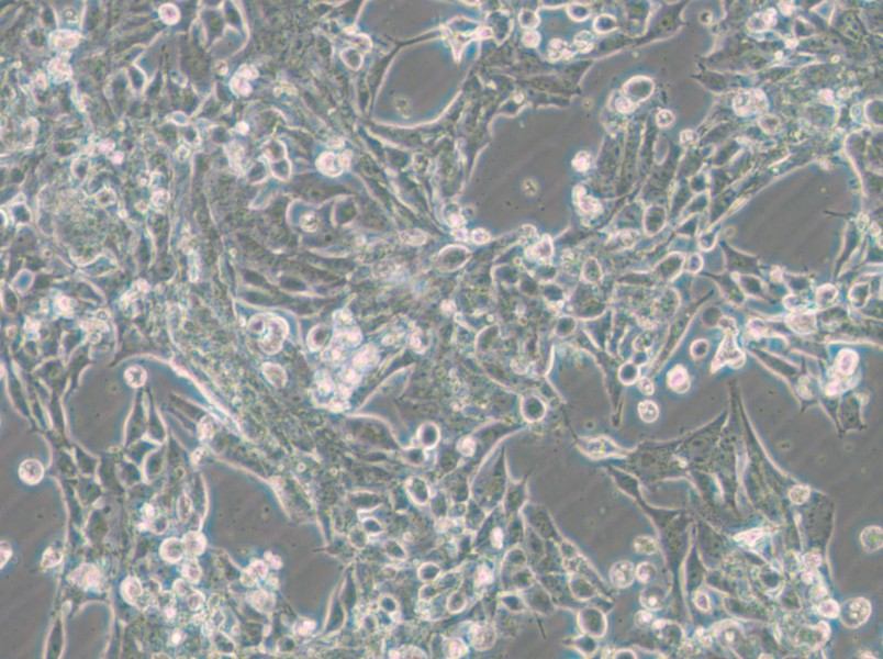 SNU-398 Cell Complete Medium - small - 11