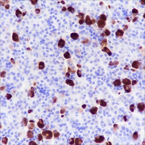 Recombinant FSH beta Monoclonal Antibody - small - 3