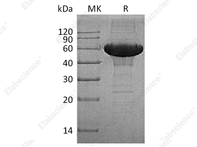 Recombinant Human MMP-3 Protein (His Tag) - 1