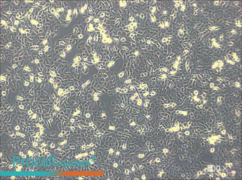IOMM-Lee Cell Complete Medium - 2