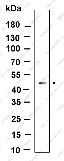 Recombinant ILK Monoclonal Antibody - 1