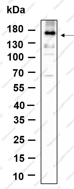 Recombinant Phospho-EGFR (Tyr1068) Monoclonal Antibody - 1
