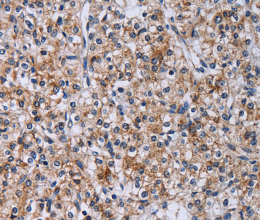 CA4 Polyclonal Antibody - 3