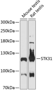 Western blot analysis of extracts of various cell lines using STK31 Polyclonal Antibody at 1:3000 dilution.