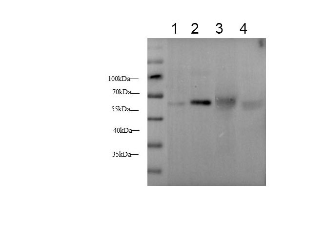 Western blot with anti-alpha 1 Antitrypsin Polyclonal antibody at dilution of 1:200.lane 1: Rat kidney tissue, lane 2:Mouse liver tissue, lane 3: Human plasma, lane 4:HepG2 whole cell lysate